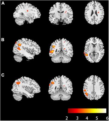 Diffusion kurtosis imaging and diffusion tensor imaging parameters applied to white matter and gray matter of patients with anti-N-methyl-D-aspartate receptor encephalitis